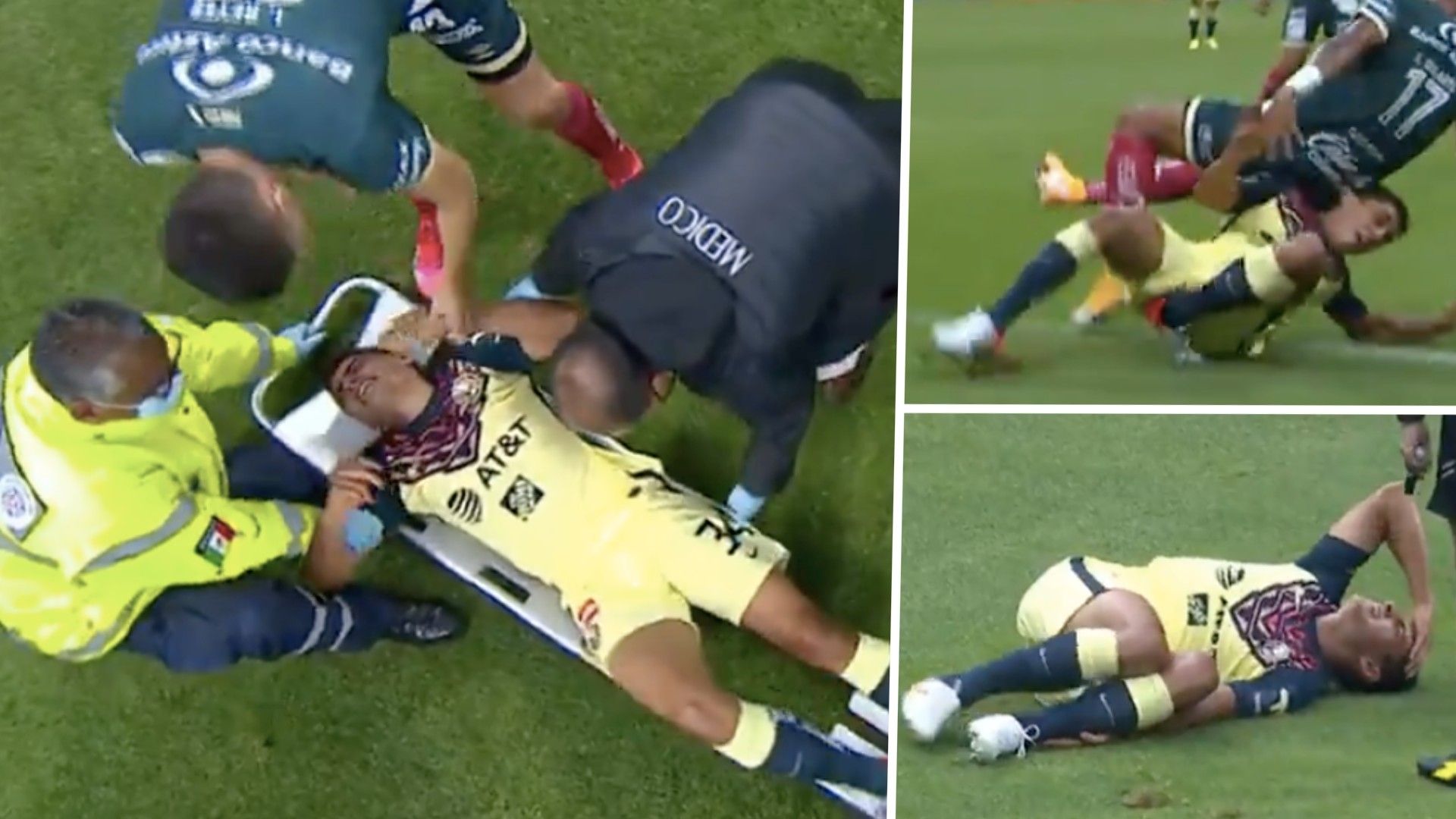 Lesión Santiago Naveda