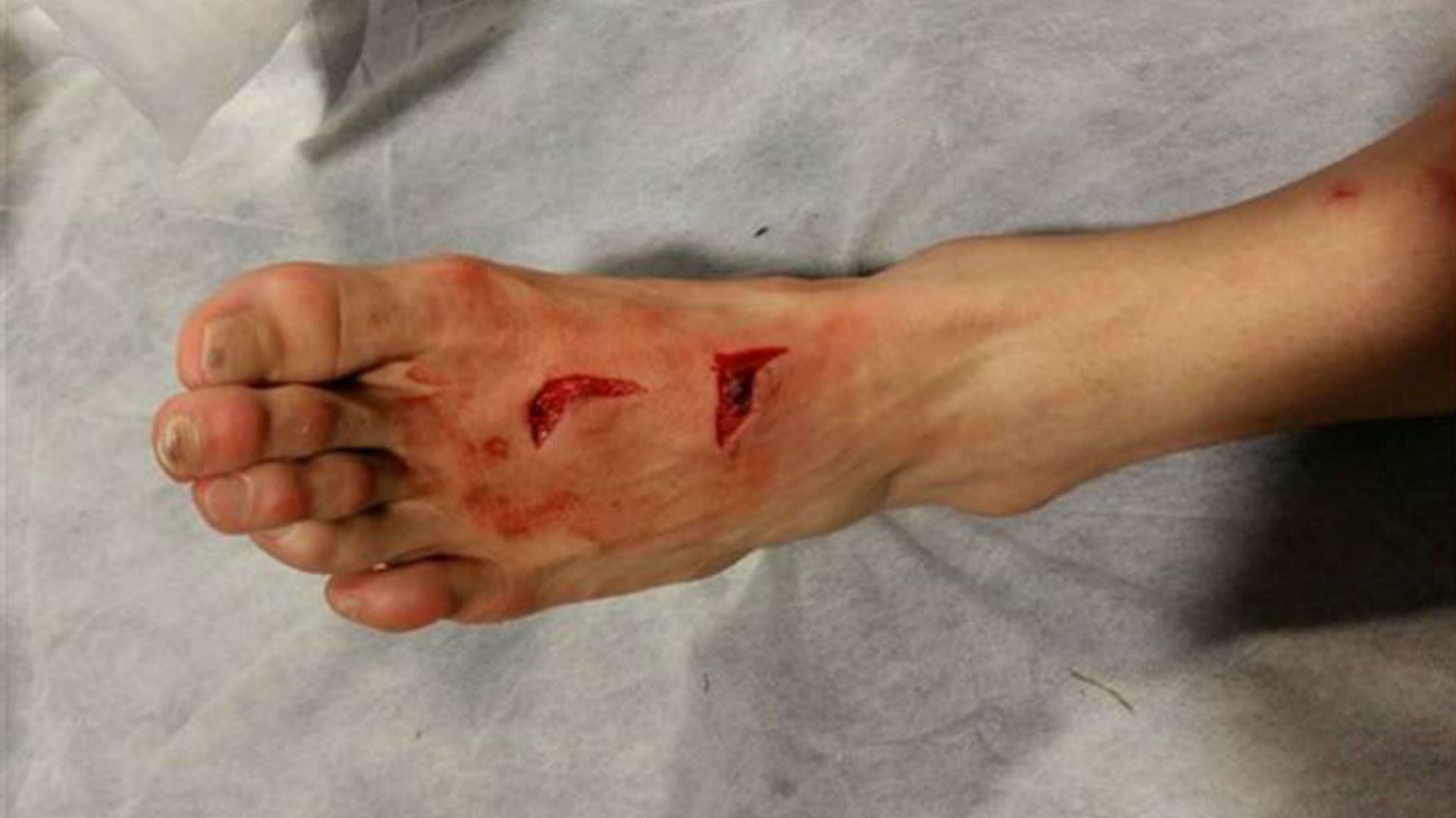 Hector Herrera Porto foot