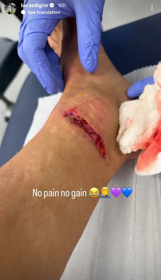 Lucas Digne injury