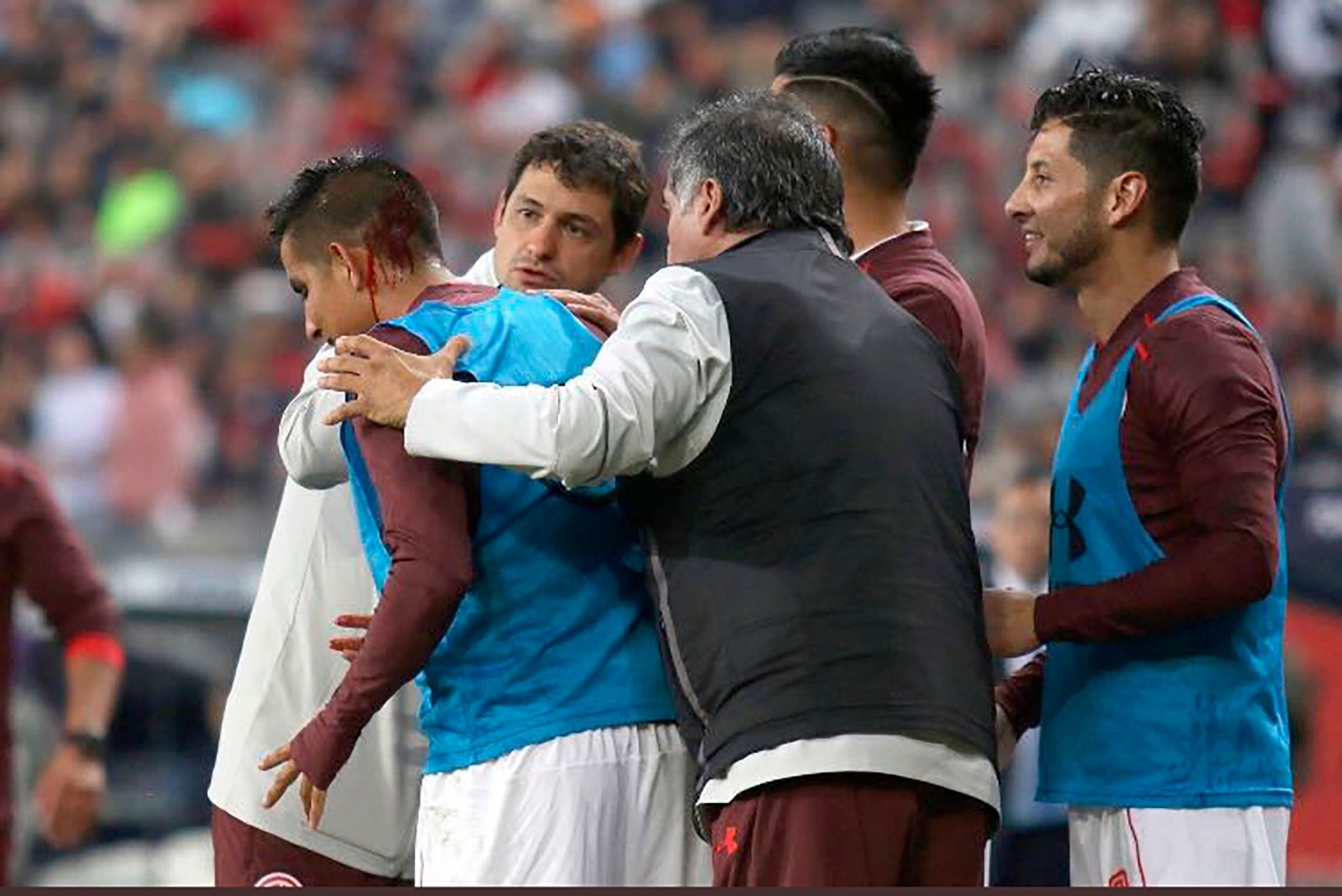 Toluca