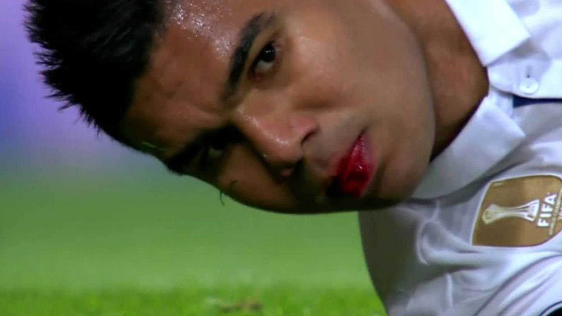 Casemiro sangre