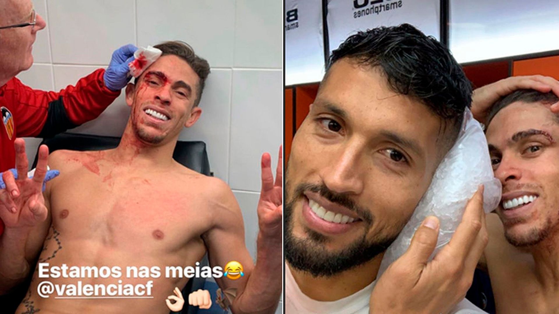 Gabriel Paulista Valencia após choque com Garay 30 01 19