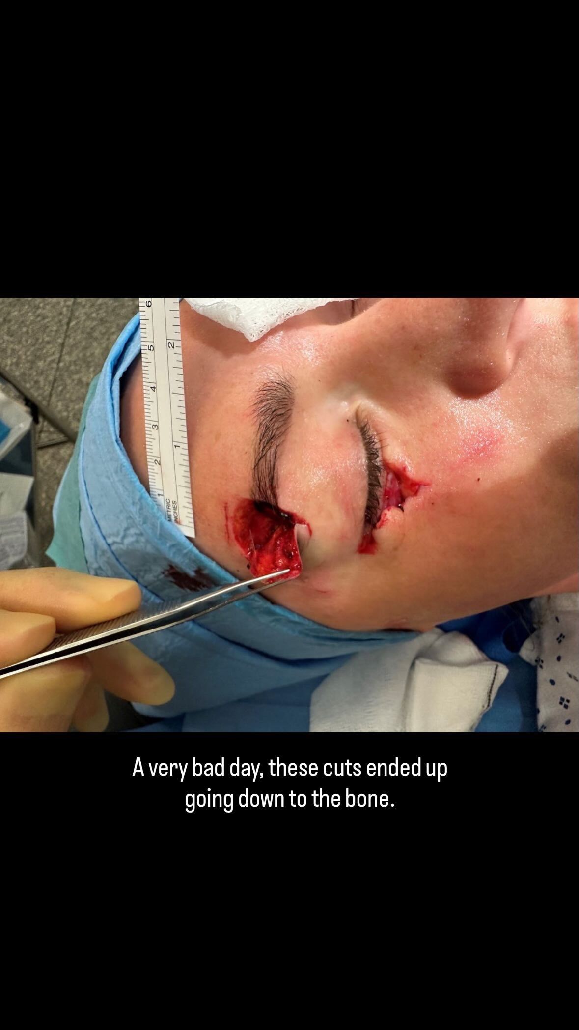 Laura Woods recovery 1 