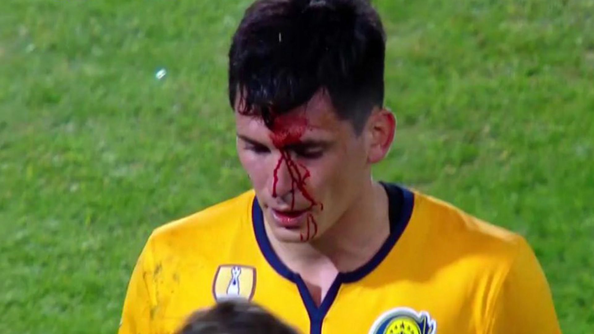 captura Parot Rosario Central Boca Supercopa 02052019