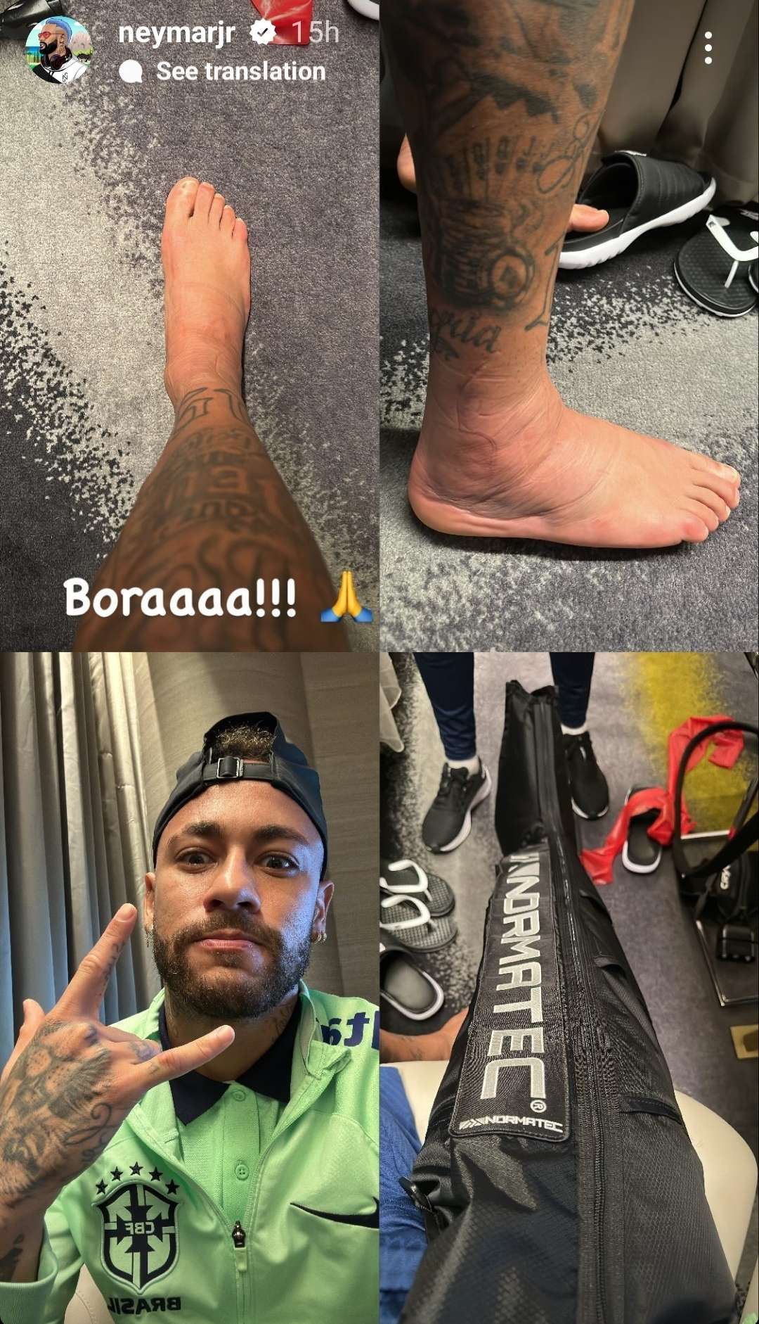 Neymar injury update
