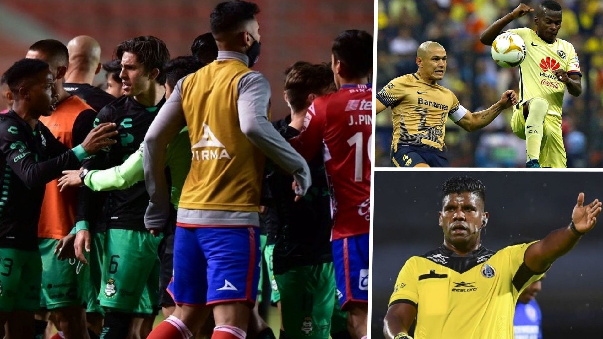 Racismo en la Liga MX