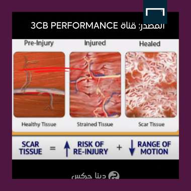 اصابات هازارد العضلية