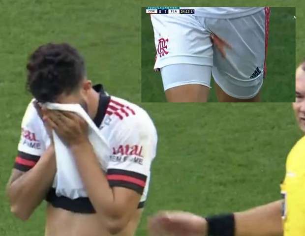 Flamengo's Gustavo Henrique leaves the field bleeding after hurting his testicle