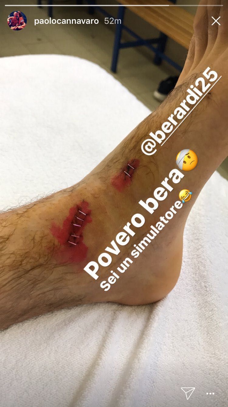 Piede Berardi - Instagram