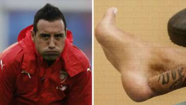 Santi Cazorla Foot Injury