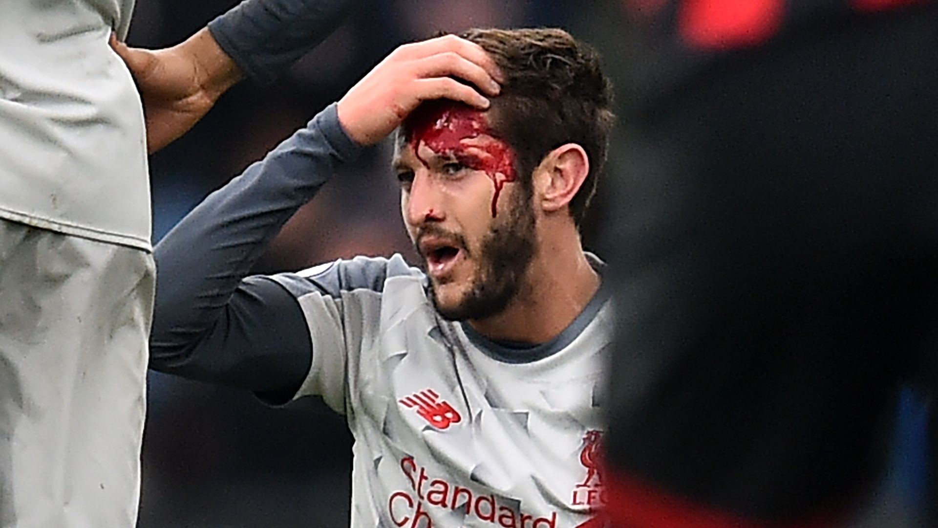Adam Lallana head injury