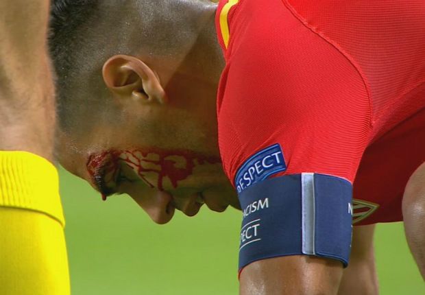 Falcao corte 26092017 Champions