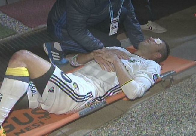 Robin van Persie eye injury HP size