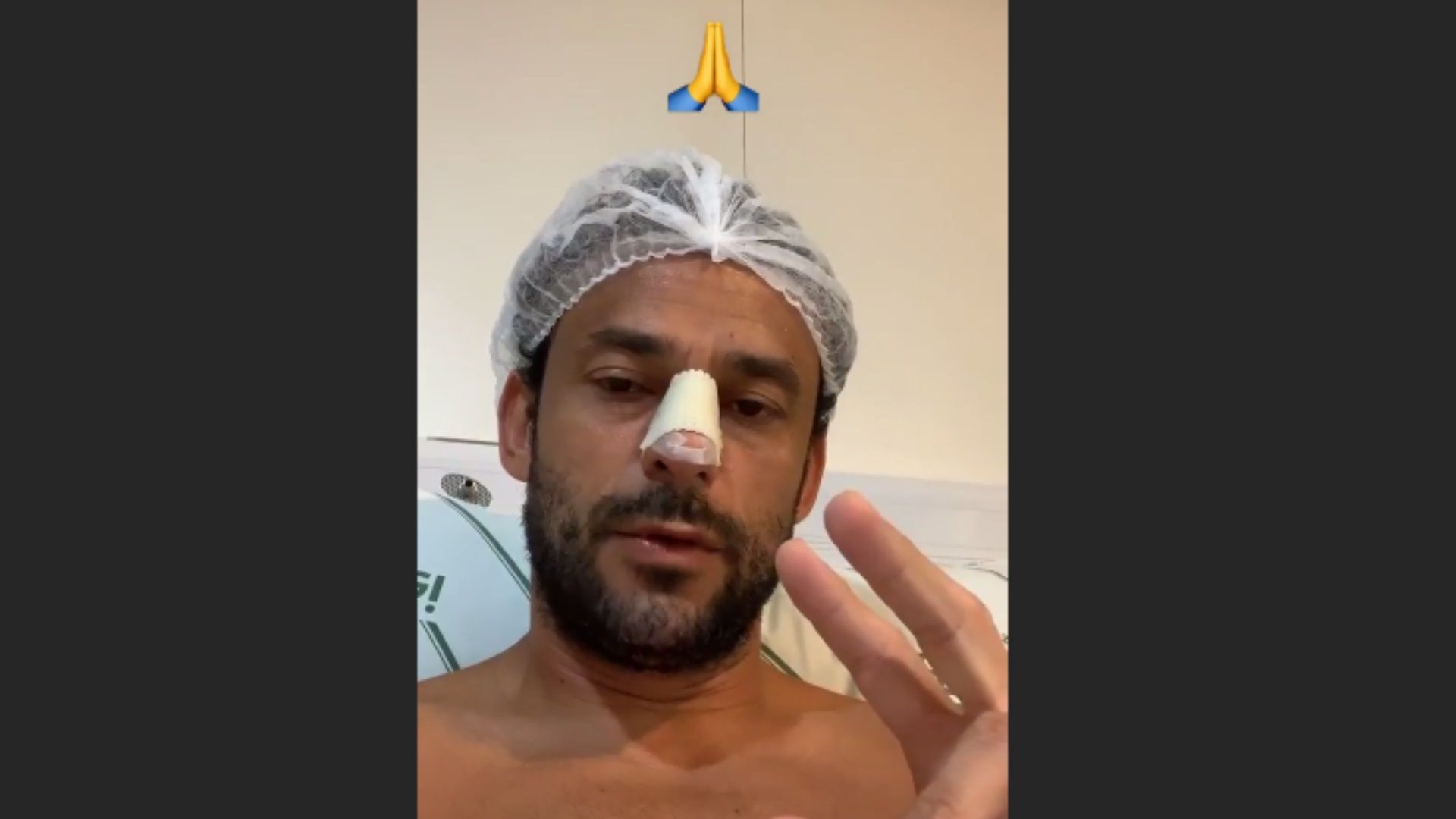 GFX Fred Cruzeiro nariz Instagram