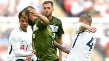 Gonzalo Higuain Tottenham Juventus