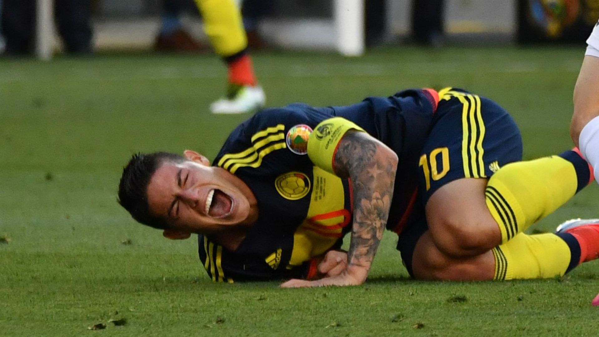 James lesión Selección Colombia Copa América 2016