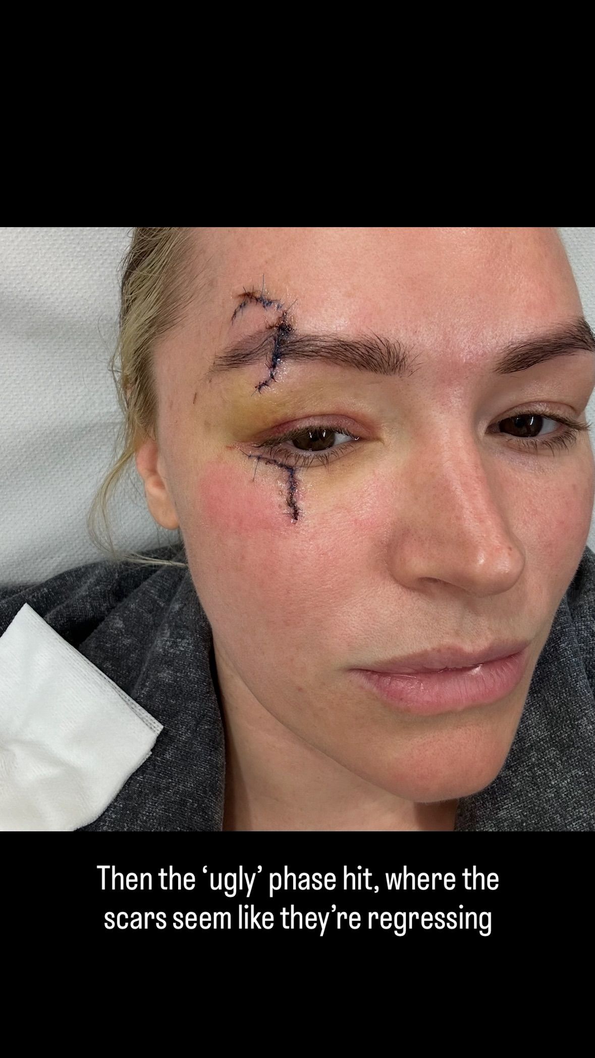 Laura Woods recovery 4