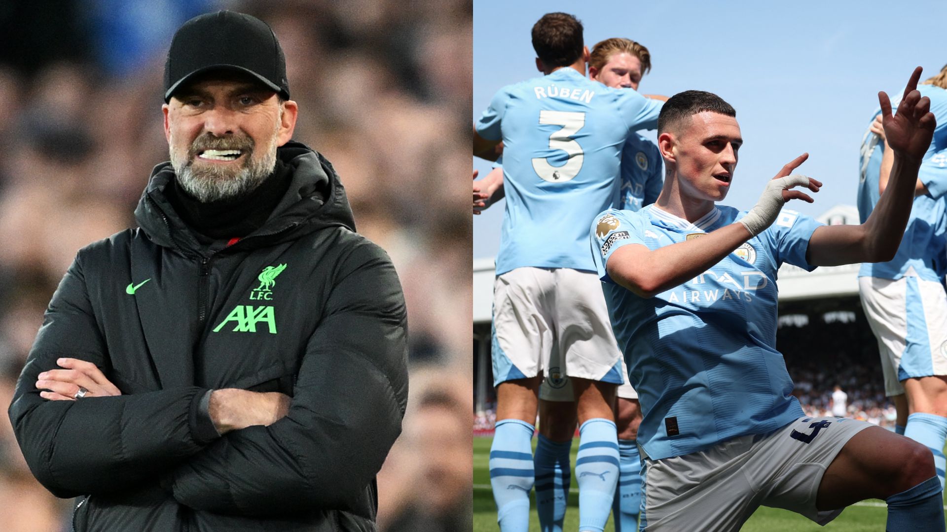 Jurgen Klopp Man City