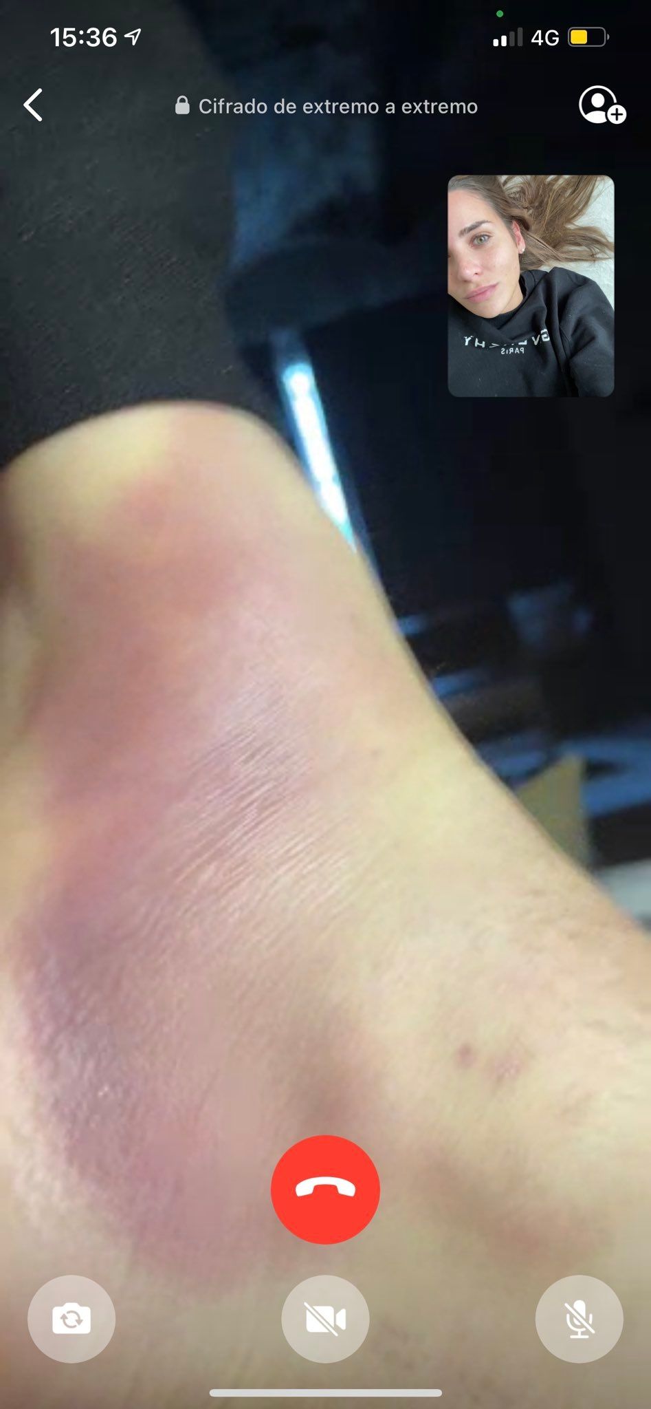 페데리코 발베르데 발목