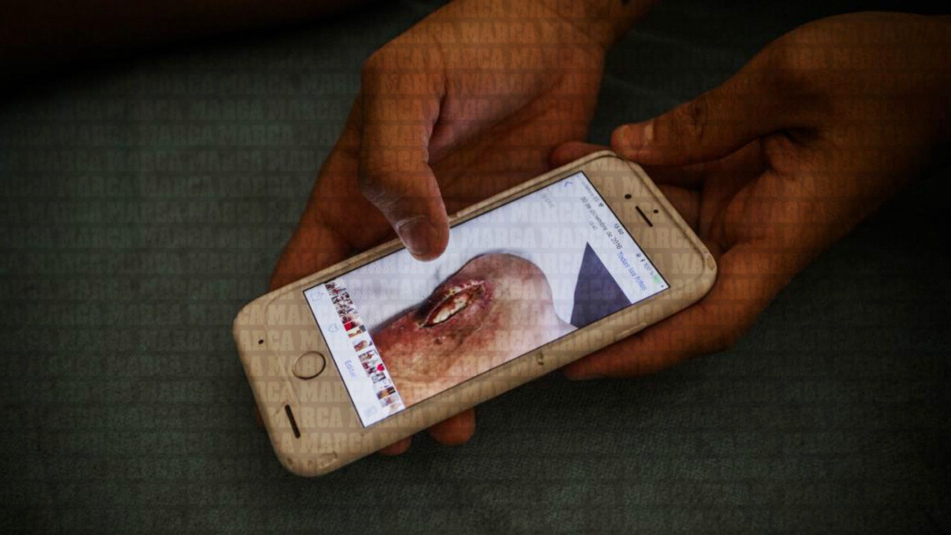 Santi Cazorla Injury