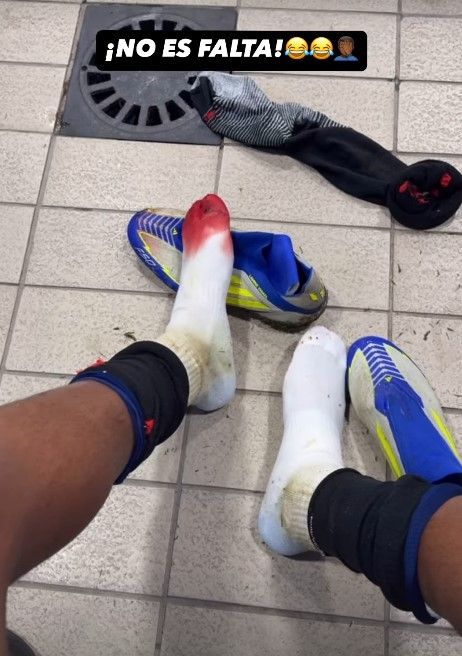 Lamine Yamal bloodied sock Barcelona Las Palmas 2024-25