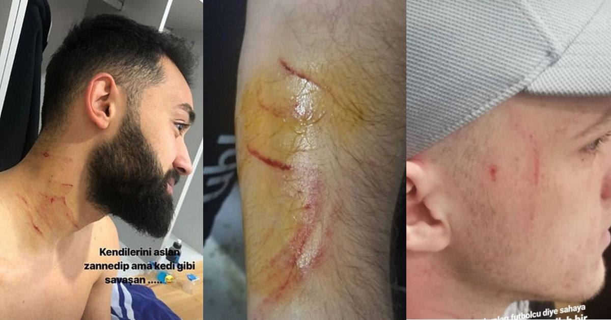 Amed SK - Sakaryaspor