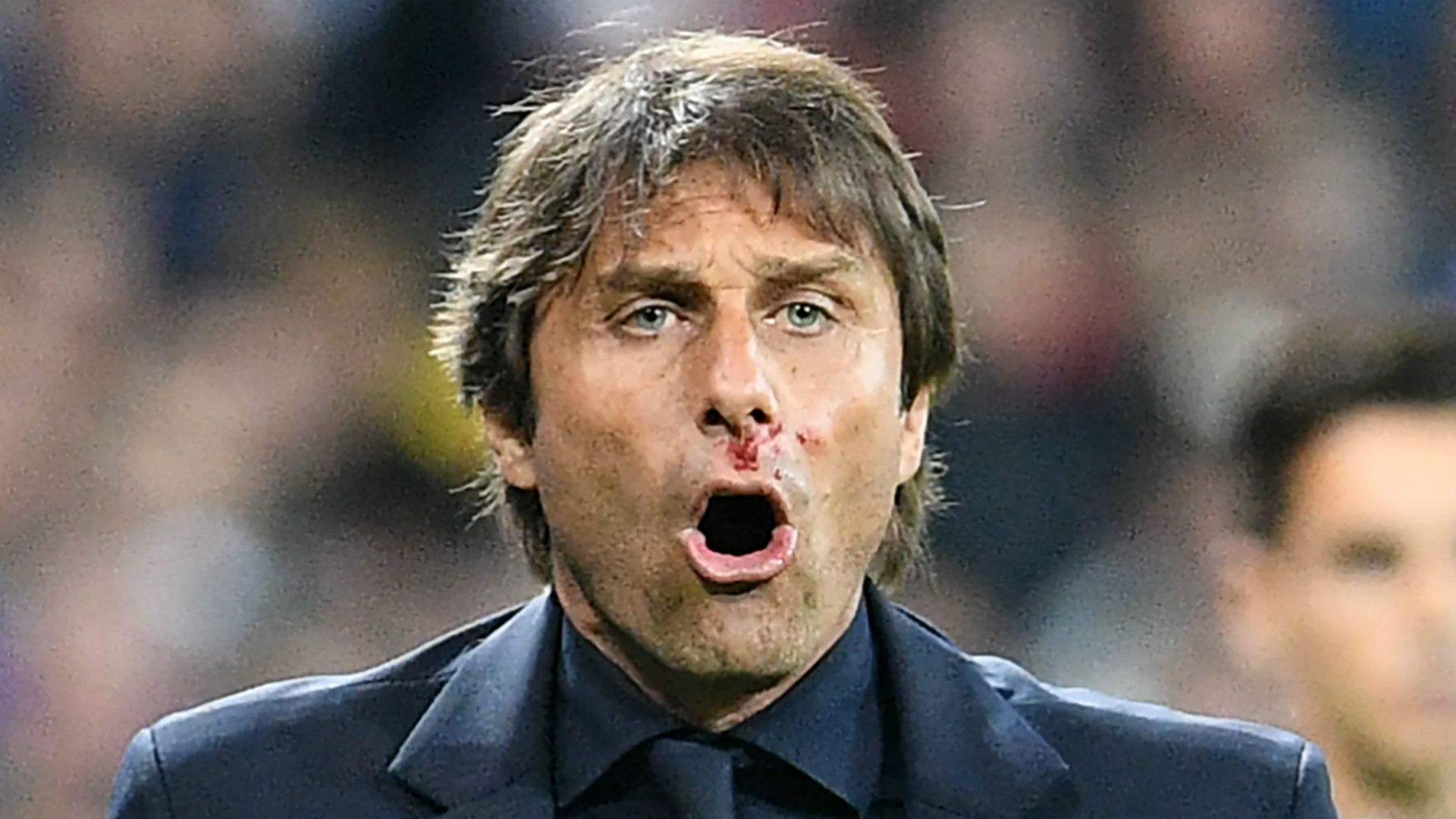 Antonio Conte Belgium Italy Euro 2016