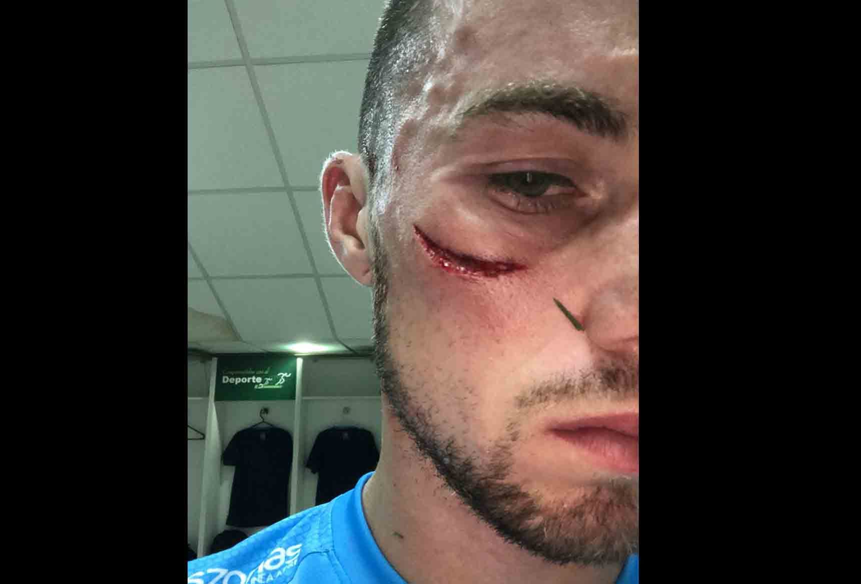 Hugo Bargas, Blooming