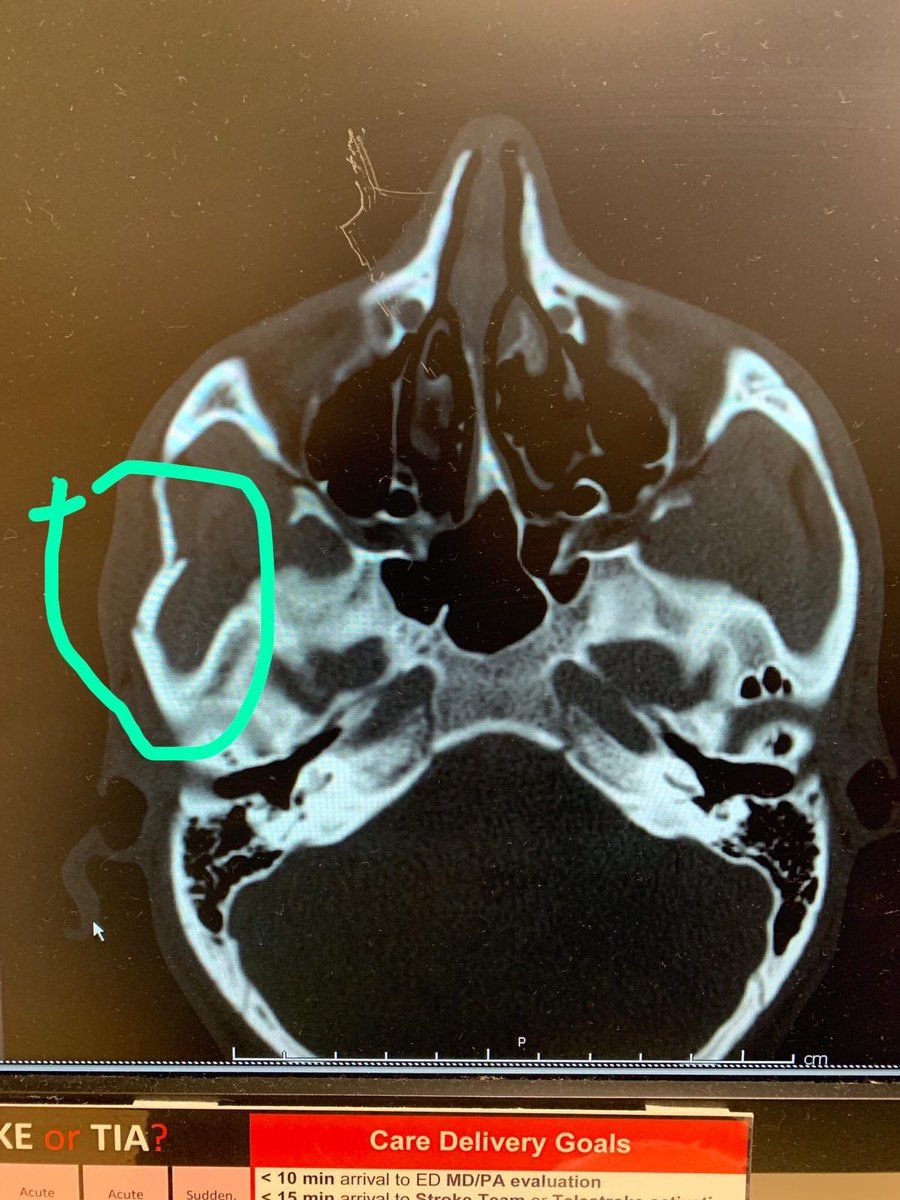 Mohamed El Munir LAFC injury