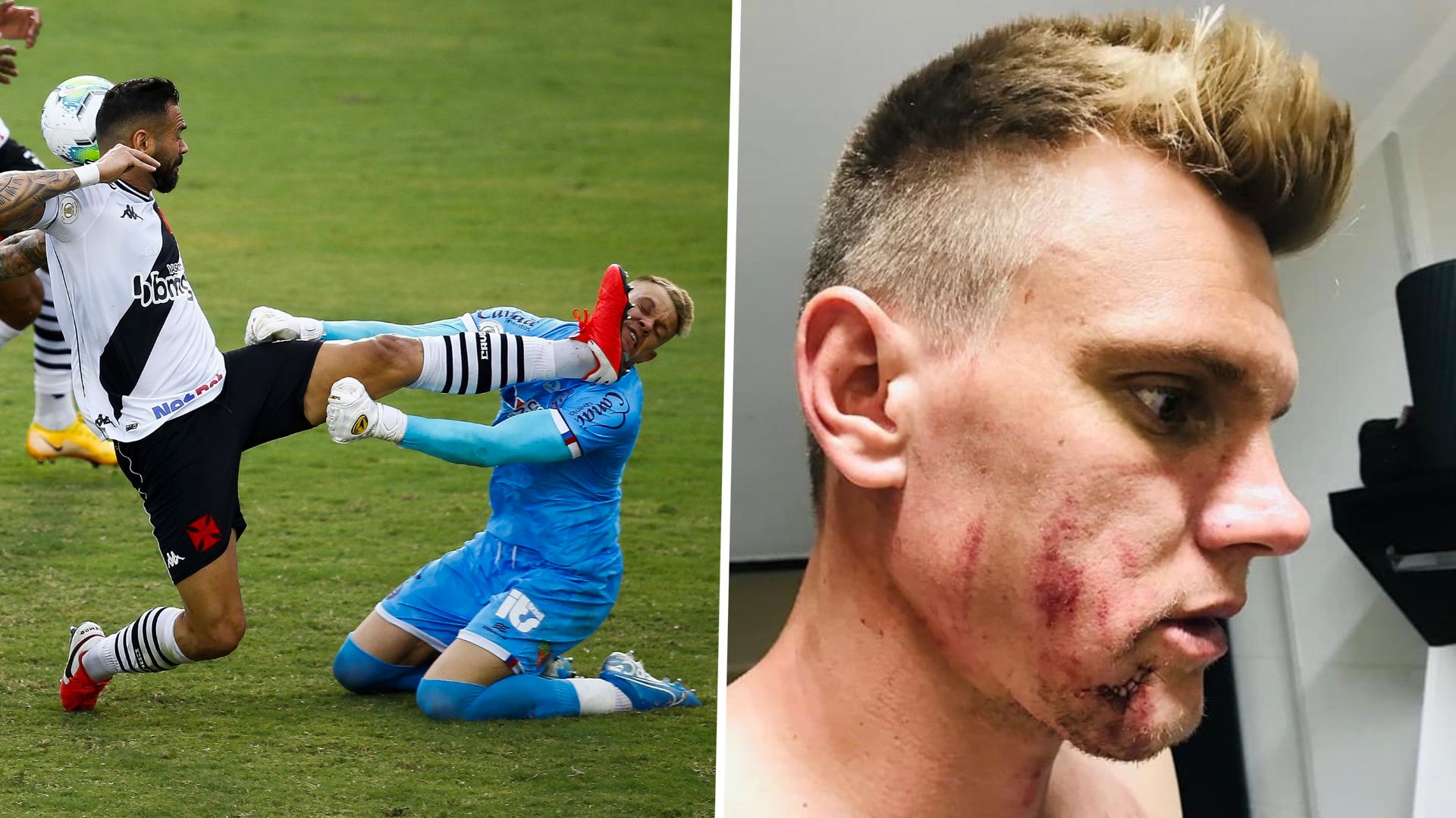 Leandro Castán & Douglas Friedrich - Vasco da Gama v Bahia : 2021