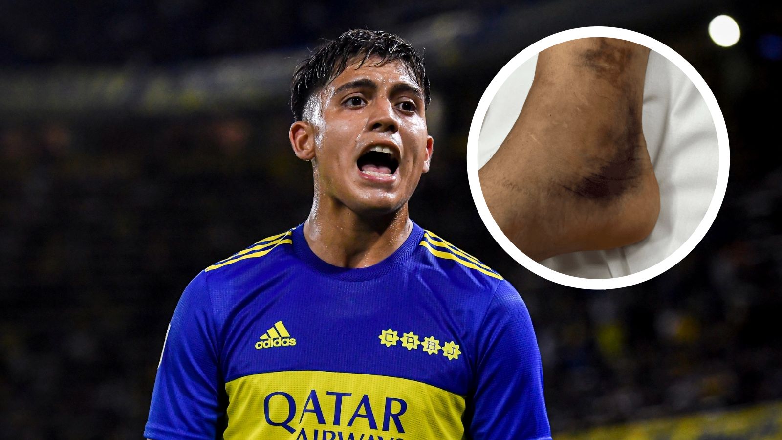 lesion exequiel zeballos boca juniors 19082022