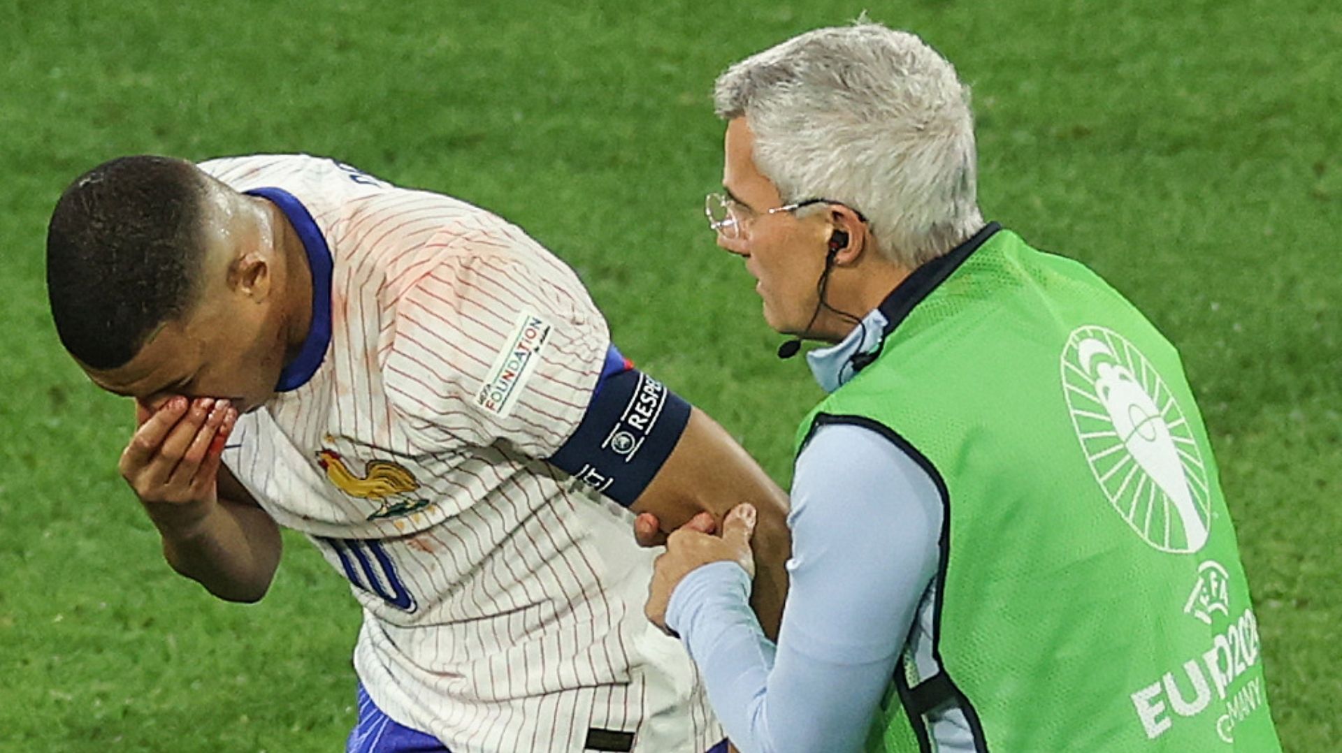 Kylian Mbappé Austria France Euro 2024 injury