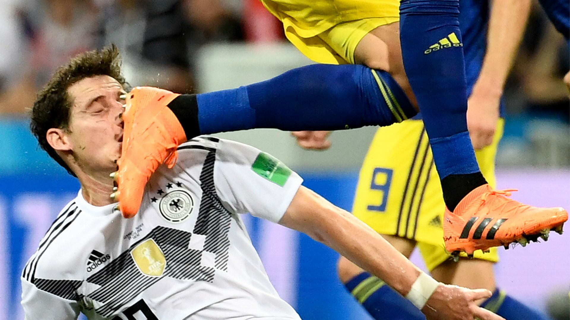 Sebastian Rudy Germany get kicked in the face vs Sweden in World Cup 2018