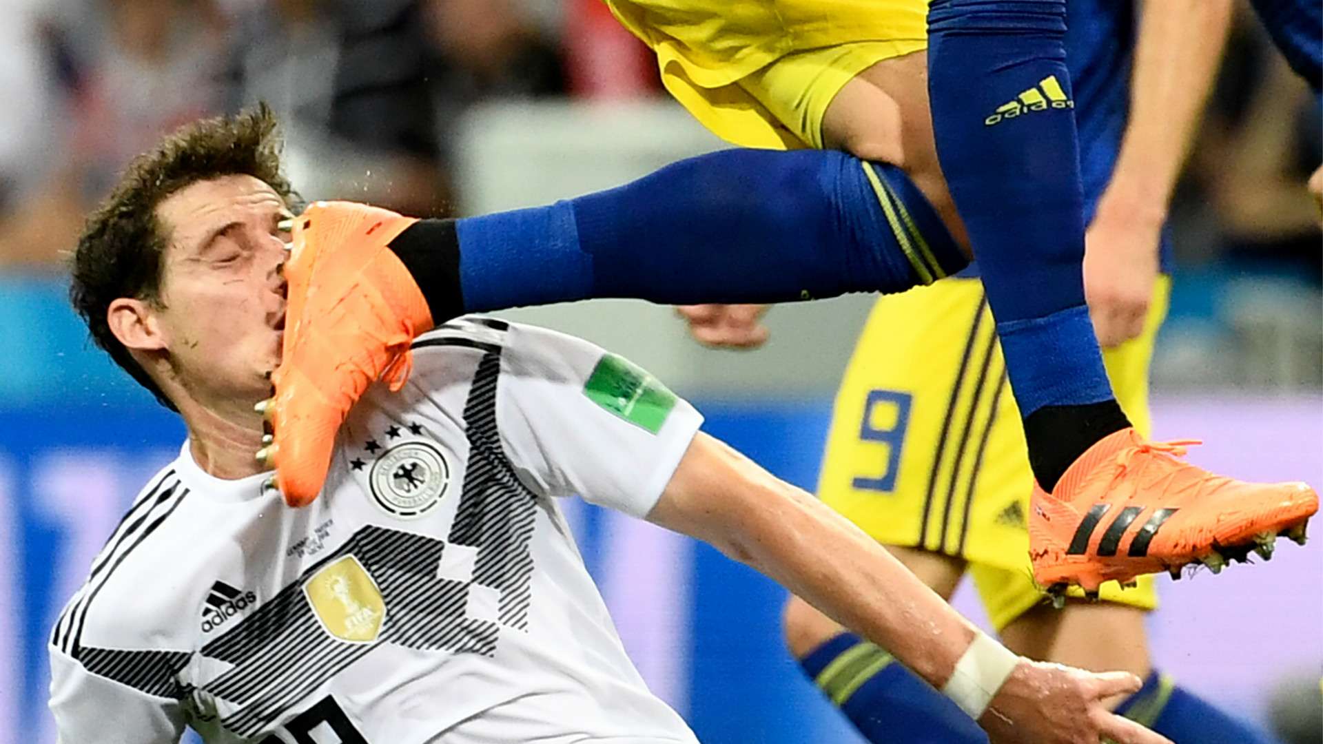 Sebastian Rudy Germany get kicked in the face vs Sweden in World Cup 2018