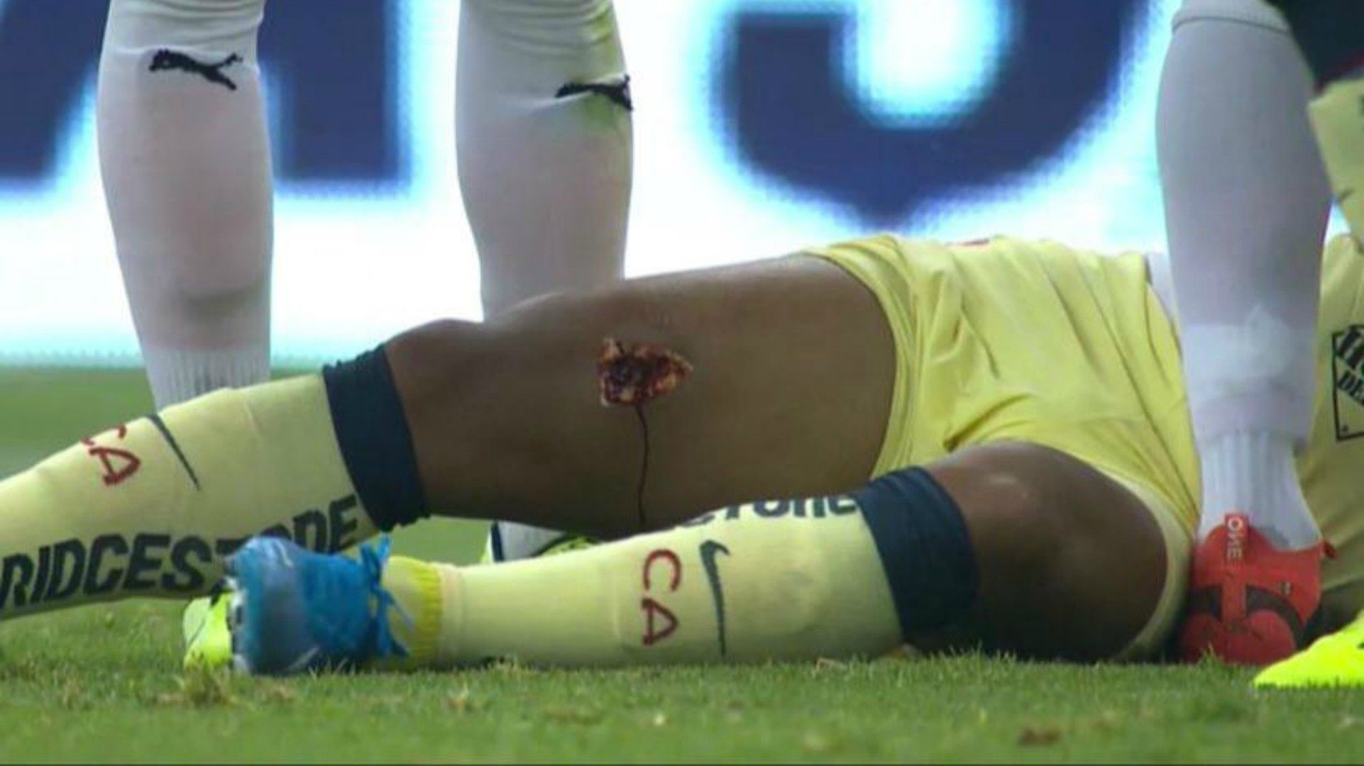 Lesión Giovani Dos Santos