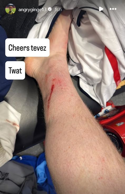 Angry Ginge Carlos Tevez Soccer Aid 20225