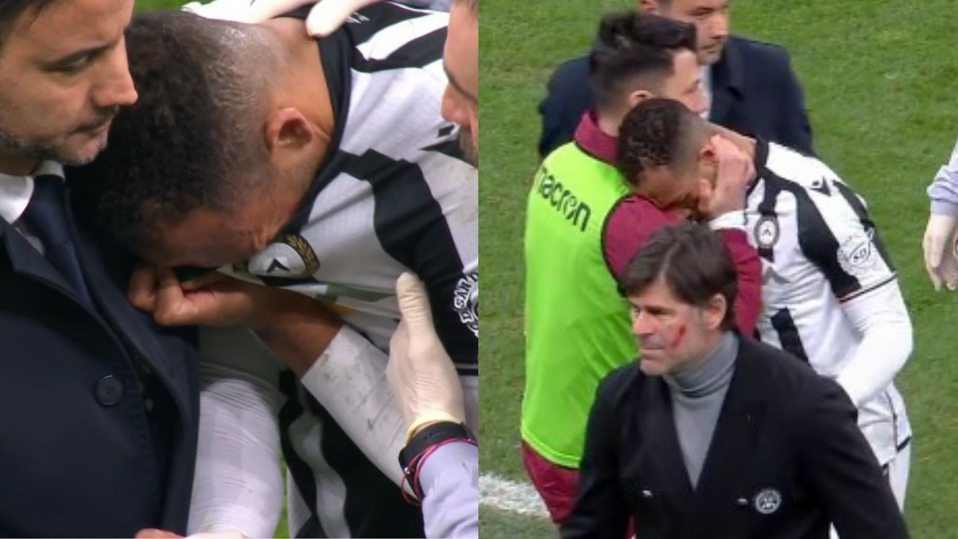 Enzo Ebosse Inter Udinese Serie A