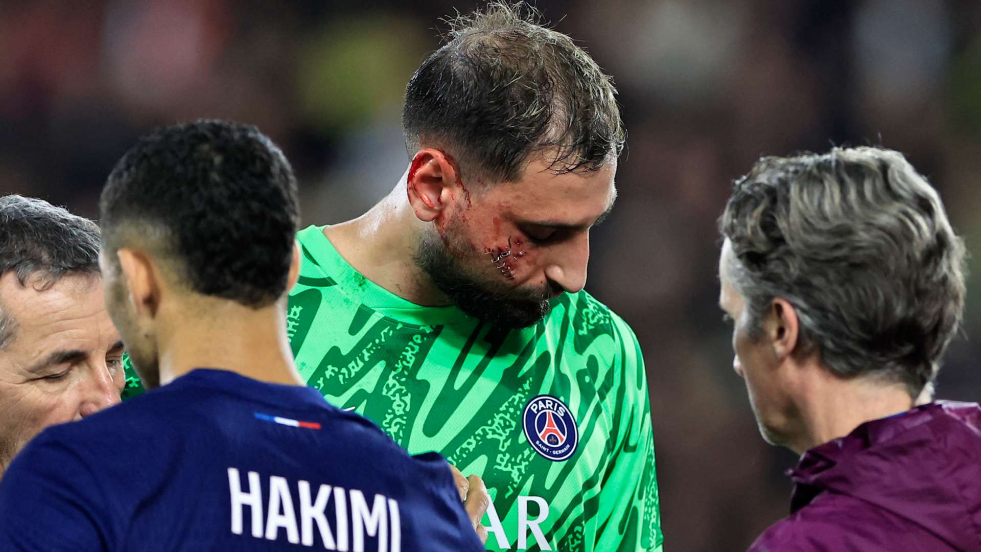 PSG offer update on Gianluigi Donnarumma after goalkeeper suffers horrific injuries when being kicked in the face during Monaco clash | Goal.com