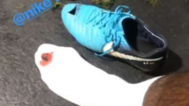 Antonio Rudiger horror injury