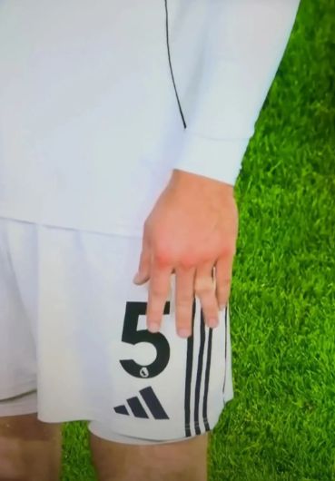 Joachim Andersen finger broken Fulham 2025-26
