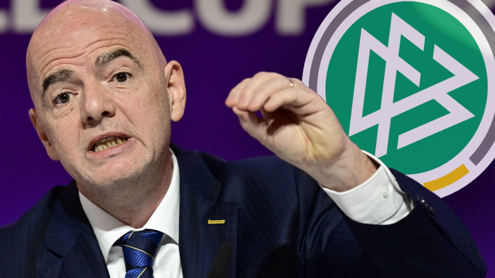 GERMANY ONLY: GFX INFANTINO