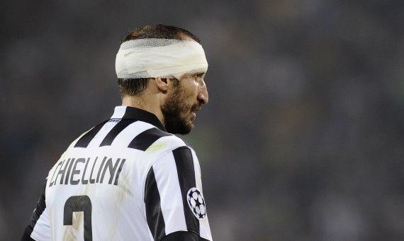 Giorgio Chiellini