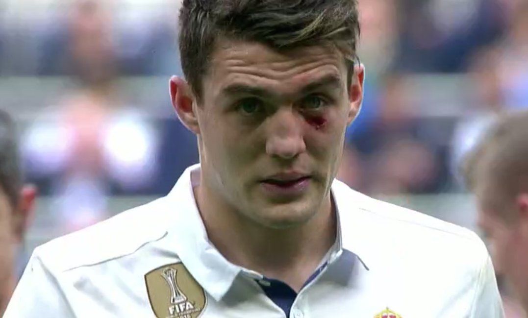 BODY ONLY Kovacic pain