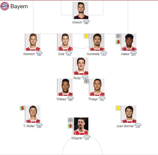 Bayern Starting vs Gladbach