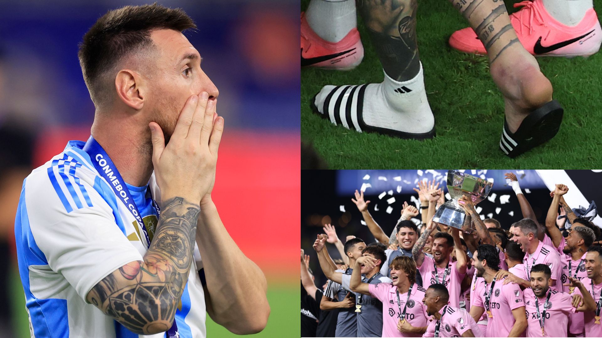 Lionel Messi ankle injury Leagues Cup