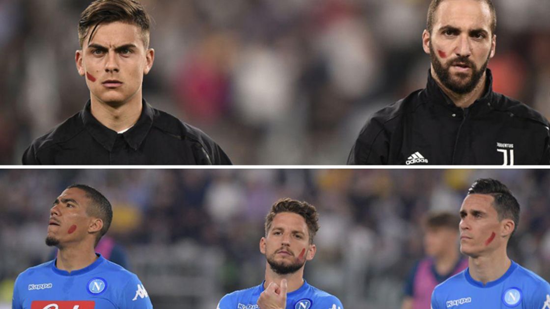 Red Stripe on Serie A players