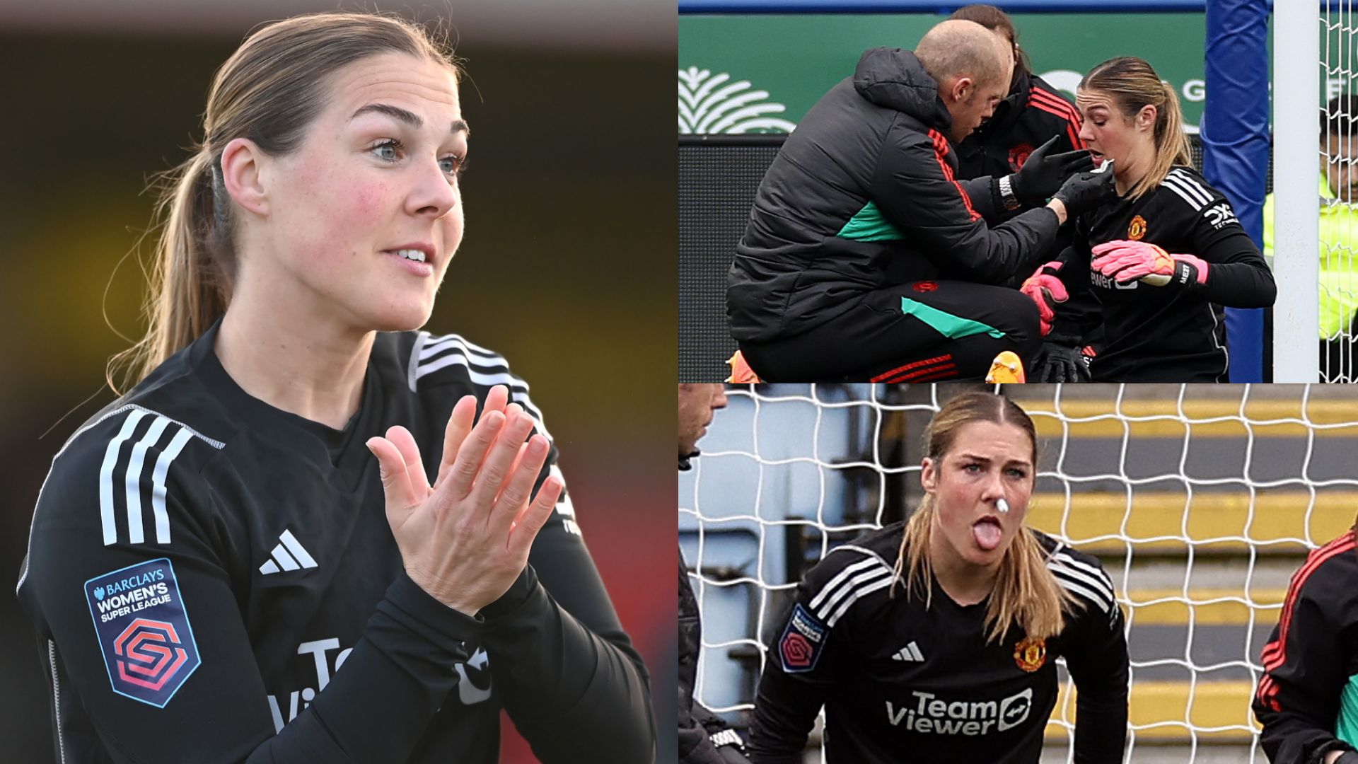 Mary Earps injury Manchester United WSL 2023-24