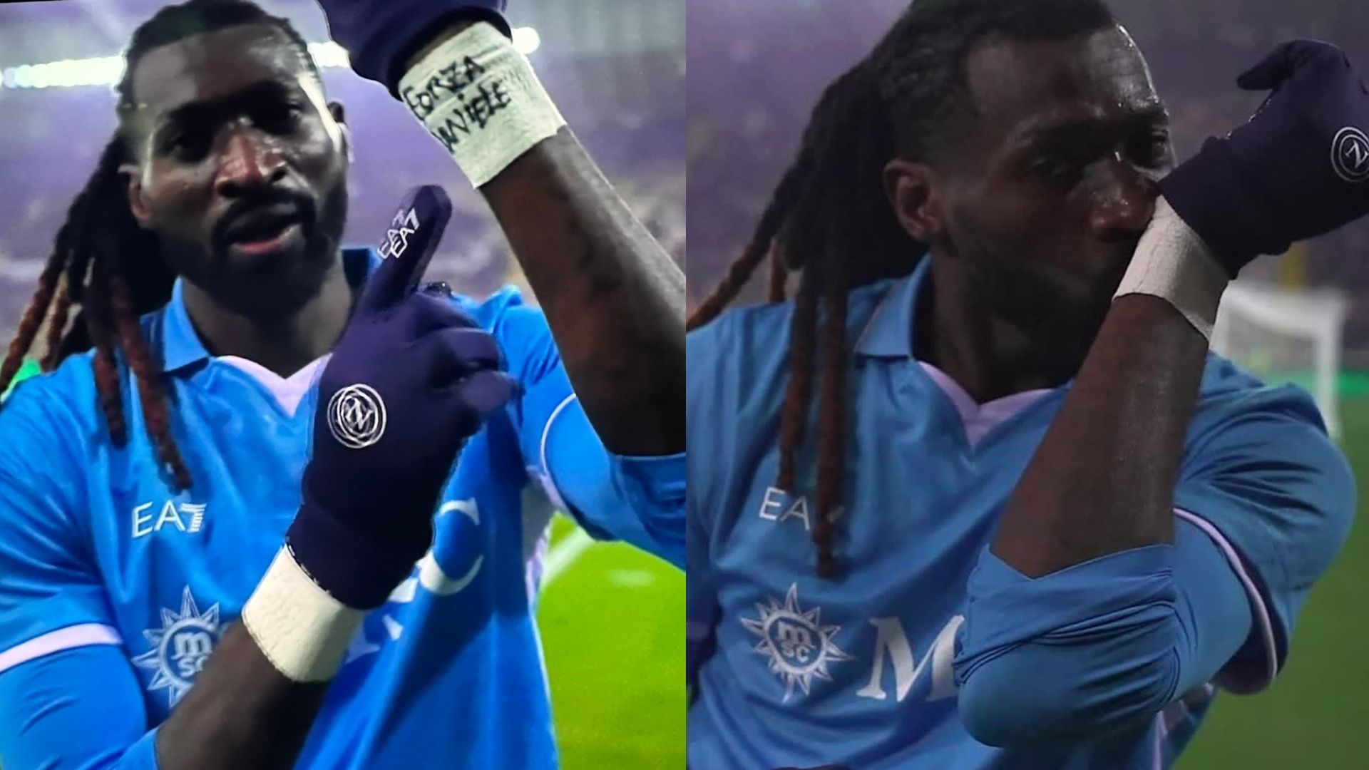 Anguissa Udinese Napoli