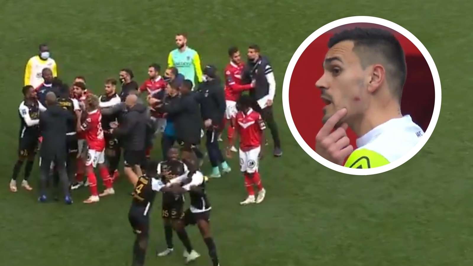 Valenciennes vs Sochaux, Jerome Prior face bite