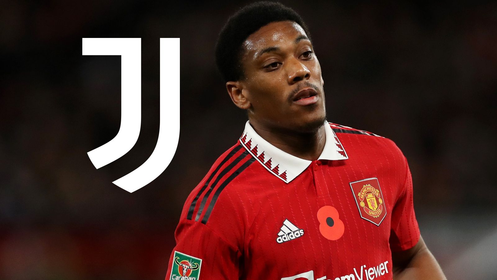 Martial Manchester United Juventus 2022